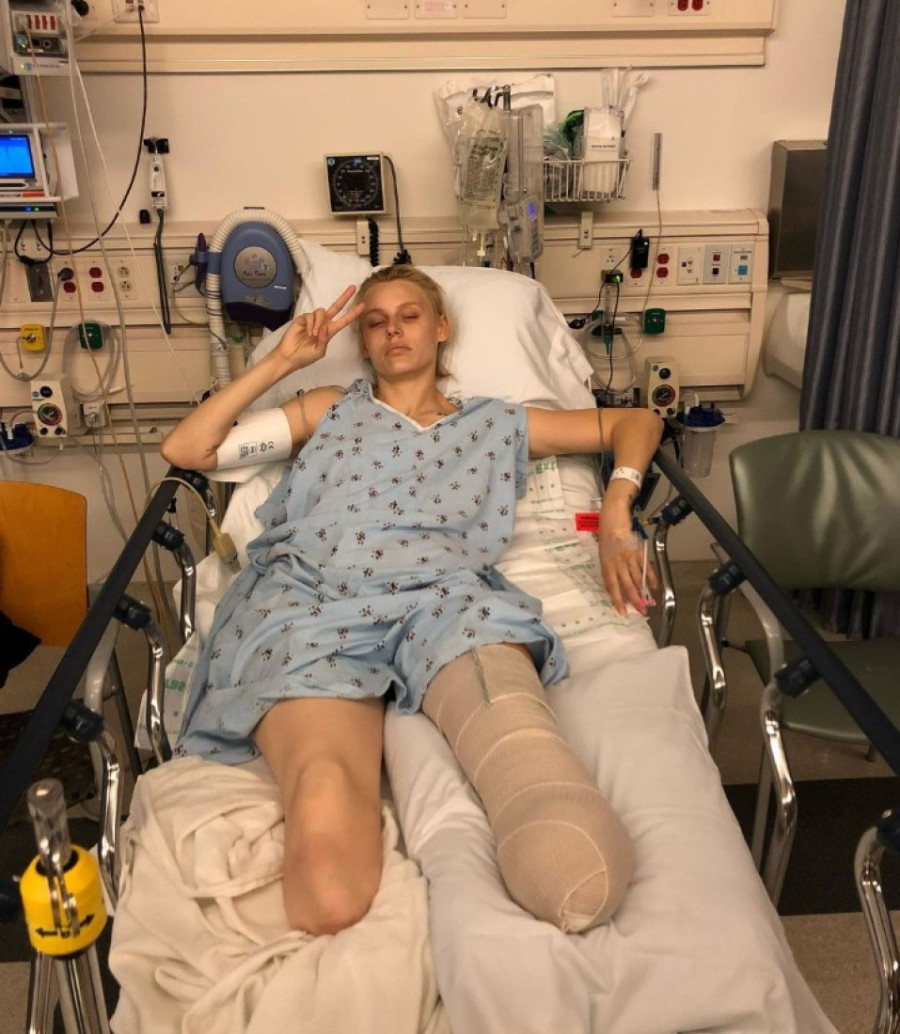 Manekenki amputirane obe noge jer je koristila tampon: Ali ovo može da se desi svakoj devojci!