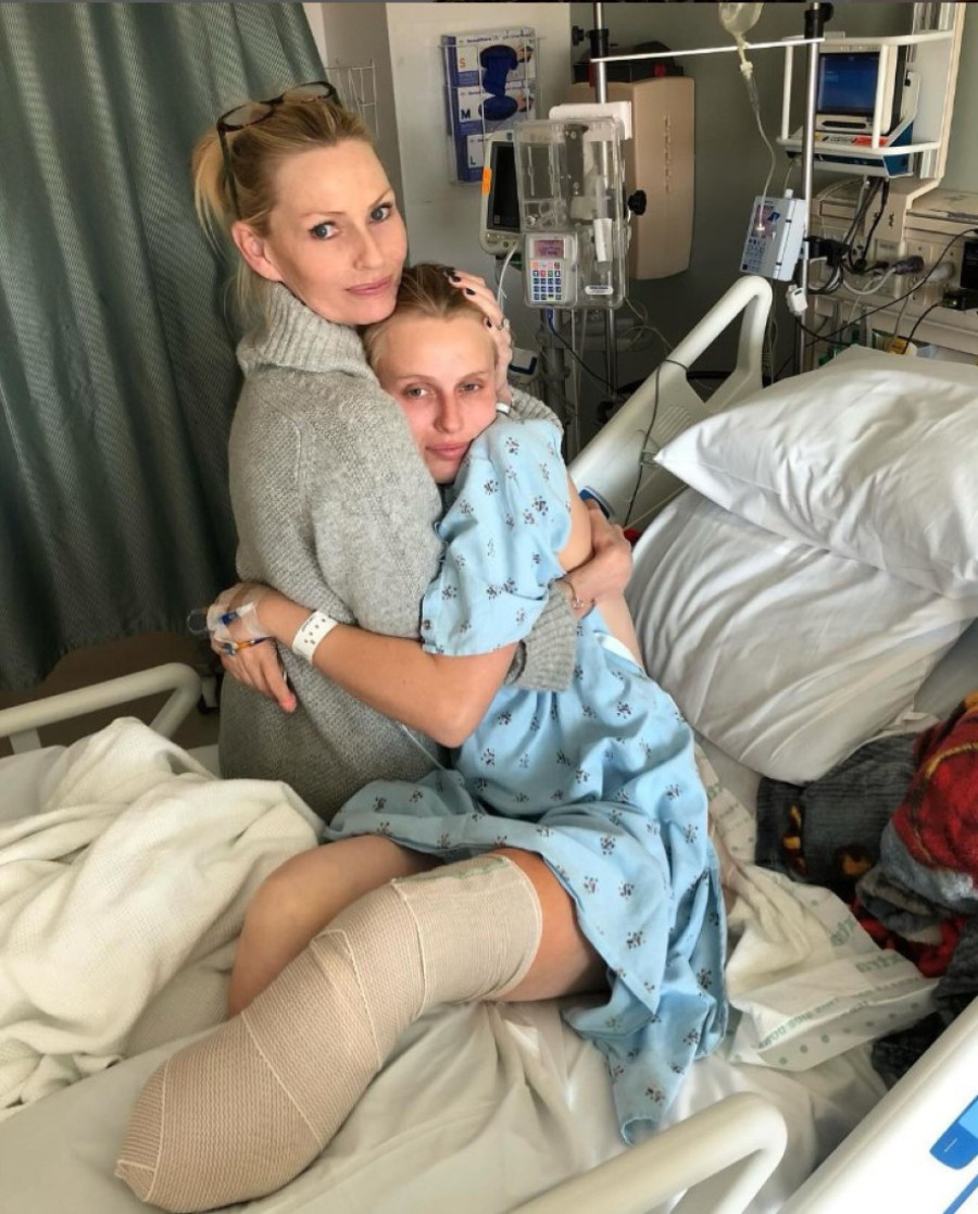 Manekenki amputirane obe noge jer je koristila tampon: Ali ovo može da se desi svakoj devojci!