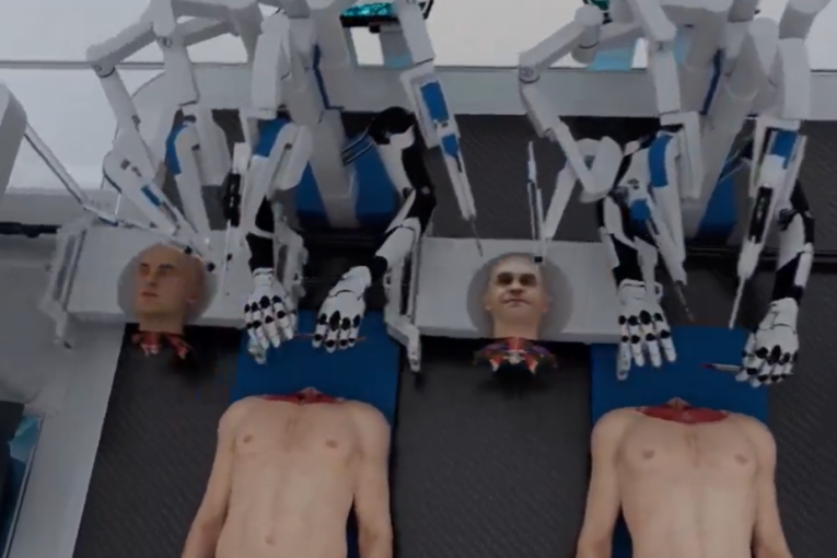 Kompanija najavila transplantaciju glave, objavila i zastrašujući video: Sve je prepušteno veštačkoj inteligenciji (VIDEO)
