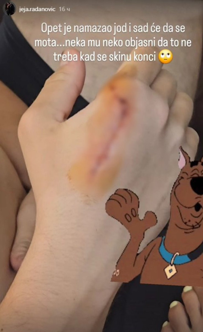 Skinuo konce, a ožiljak vidljiv preko cele šake - Evo kako izgleda ruka Slobe Radanovića nakon operacije