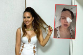 Pevačici ćerka nanela tešku povredu! Pola glave joj u zavojima, oglasila se i otkrila detalje (FOTO)