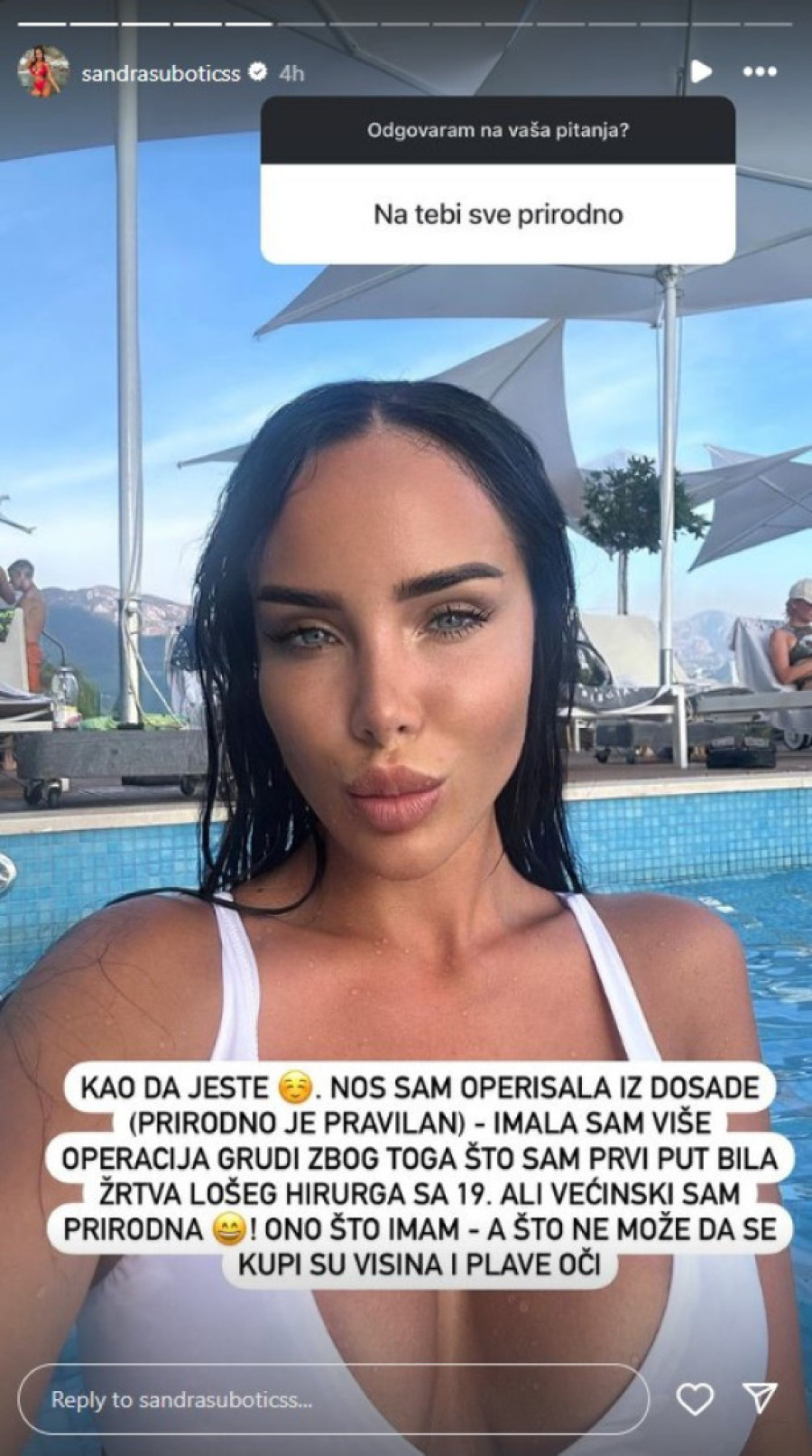 "Grudi sam operisala više puta, a nos iz dosade!" Aleksandra Subotić je bila žrtva nestručnih hirurga, otkrila šta je na njoj prirodno