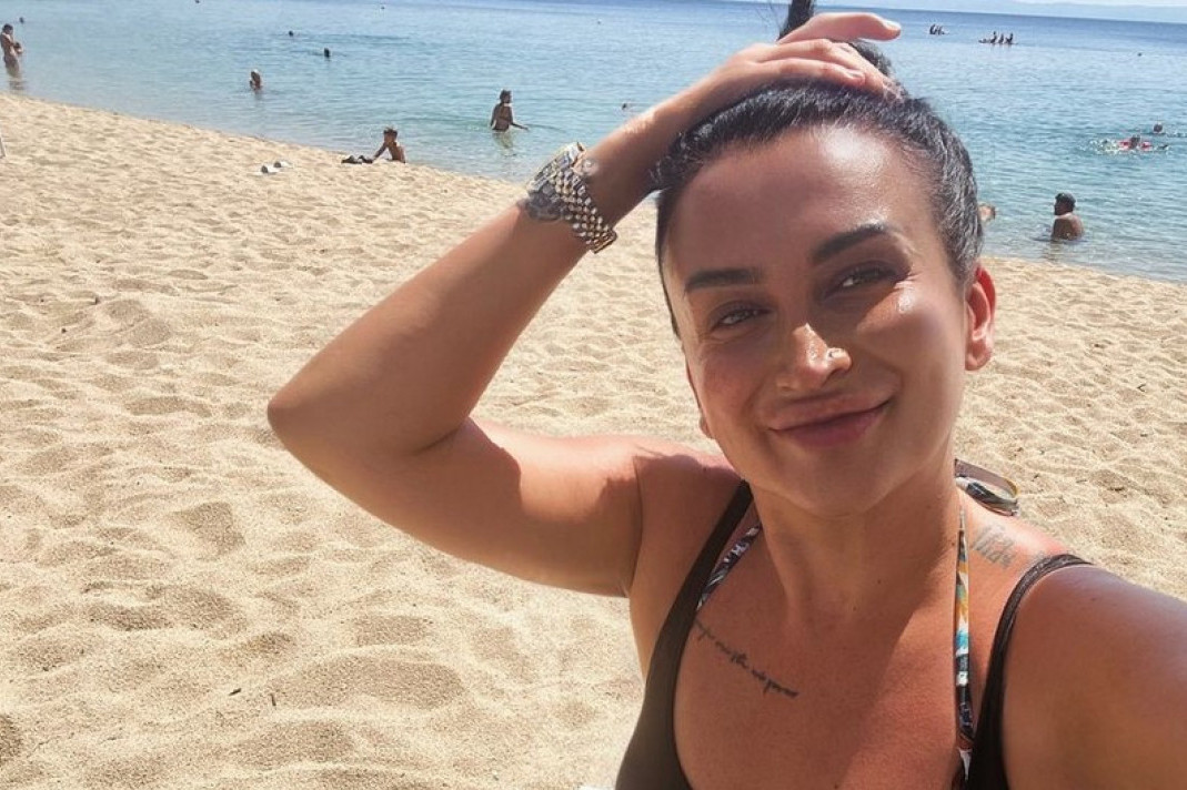 Andreana Čekić smanjila prirodne grudi, sada pokazala kako izgleda posle zahvata: Odmah istakla dekolte (FOTO)