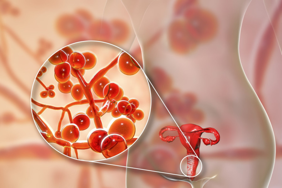 Pet vrsta namirnica koje povećavaju rizik od vaginalnih infekcija: Jednu svi obožavamo zimi, a može naneti štetu