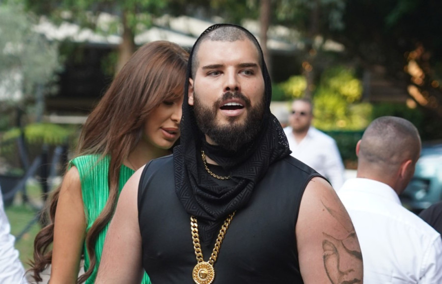 Dijana Dilajn slomila vilicu! Objavila i fotke s ušivanja - evo kako sada izgleda (FOTO)