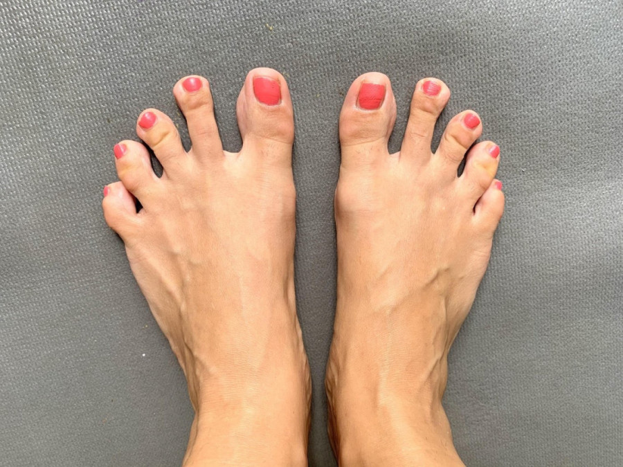 Zelene oči i razmaknuti zubi: Dvanaest fascinatnih karakteristika koje otkrivaju više o vašem zdravlju nego što mislite