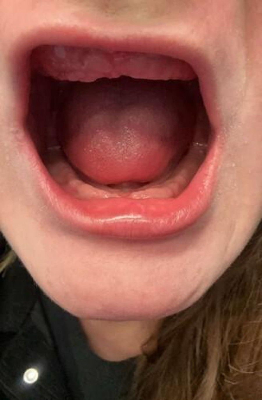 Put do katastrofe: Potpuno sam ostala bez zuba nakon puta u Tursku! (FOTO)