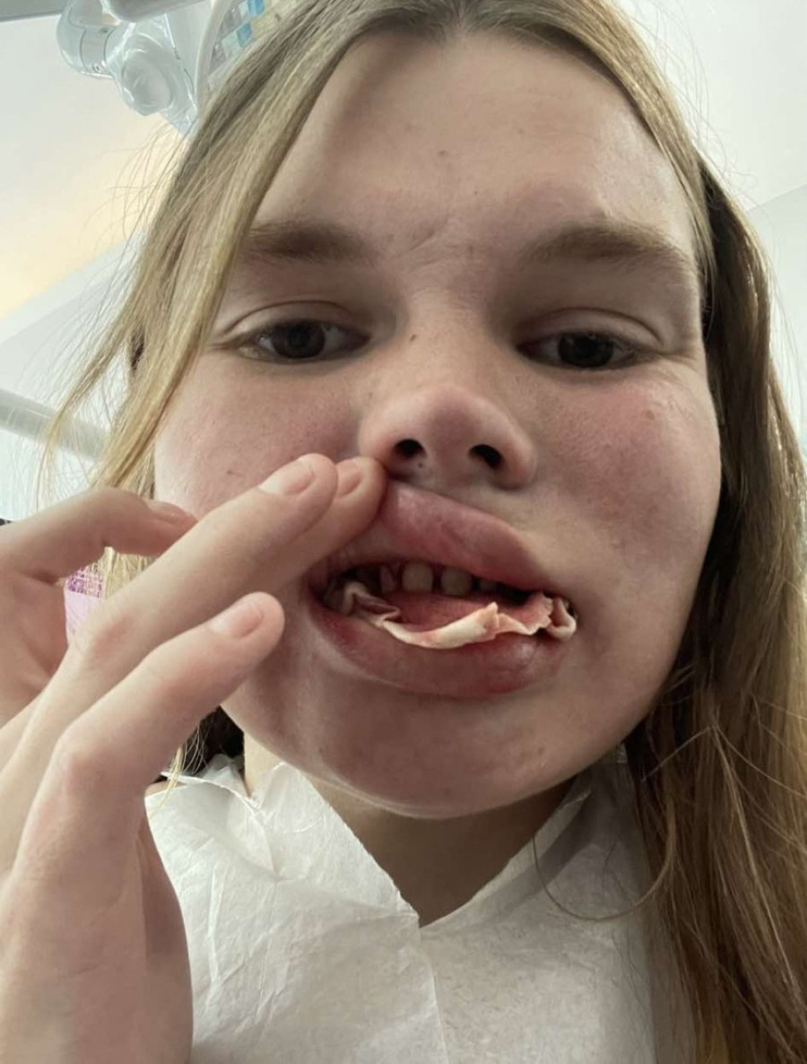 Put do katastrofe: Potpuno sam ostala bez zuba nakon puta u Tursku! (FOTO)