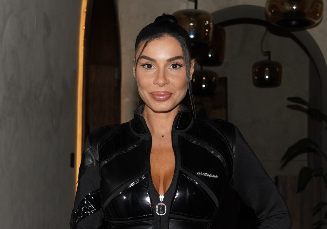 Žena tvrdi da su joj aparati Mie Borisavljević izazvali teške opekotine: Tražila mi je 15.000 evra pod pretnjom!