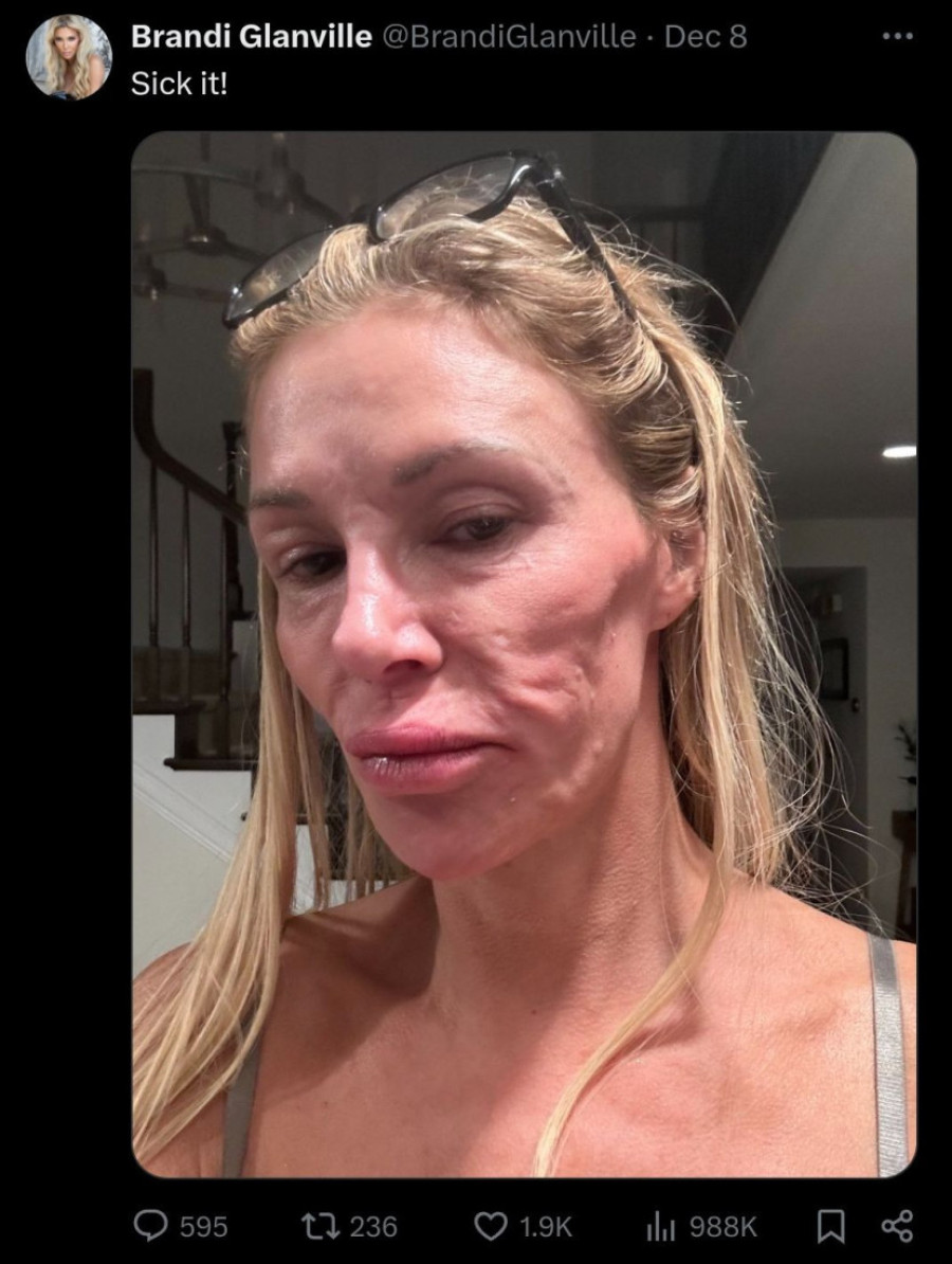 Paraziti joj promenili lični opis, jedva se izvukla! Rijaliti zvezda otkrila detalje oporavka (FOTO)