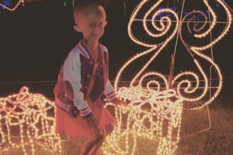 Preminula tiktokerka (19): Bolovala je od teške i veoma retke genetske bolesti