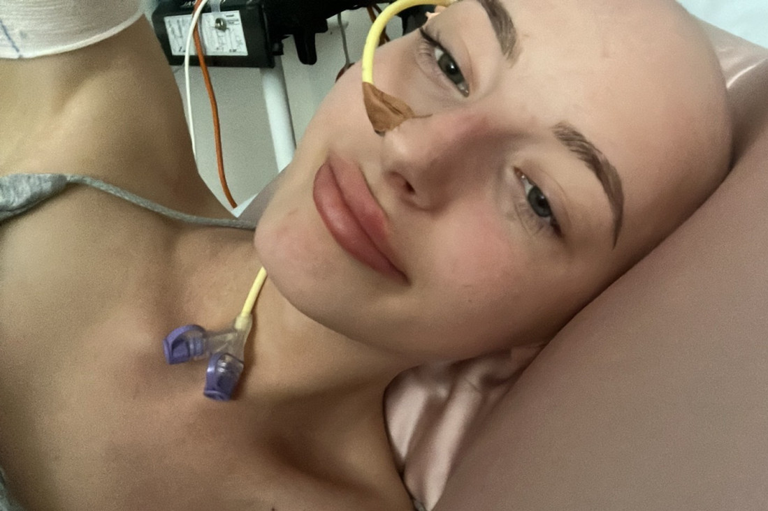 Upozorenje! Opaka bolest sve češća među mladima, brzo se širi, uzrok nepoznat, a ovo su ključni faktori rizika