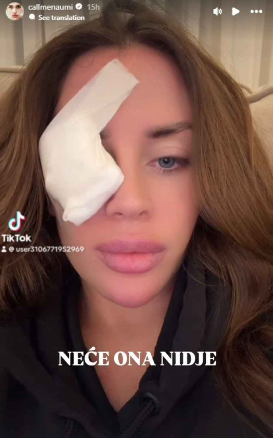 Mina Naumović se oglasila o povredi: Ognjenova žena otkrila šta joj se desilo!