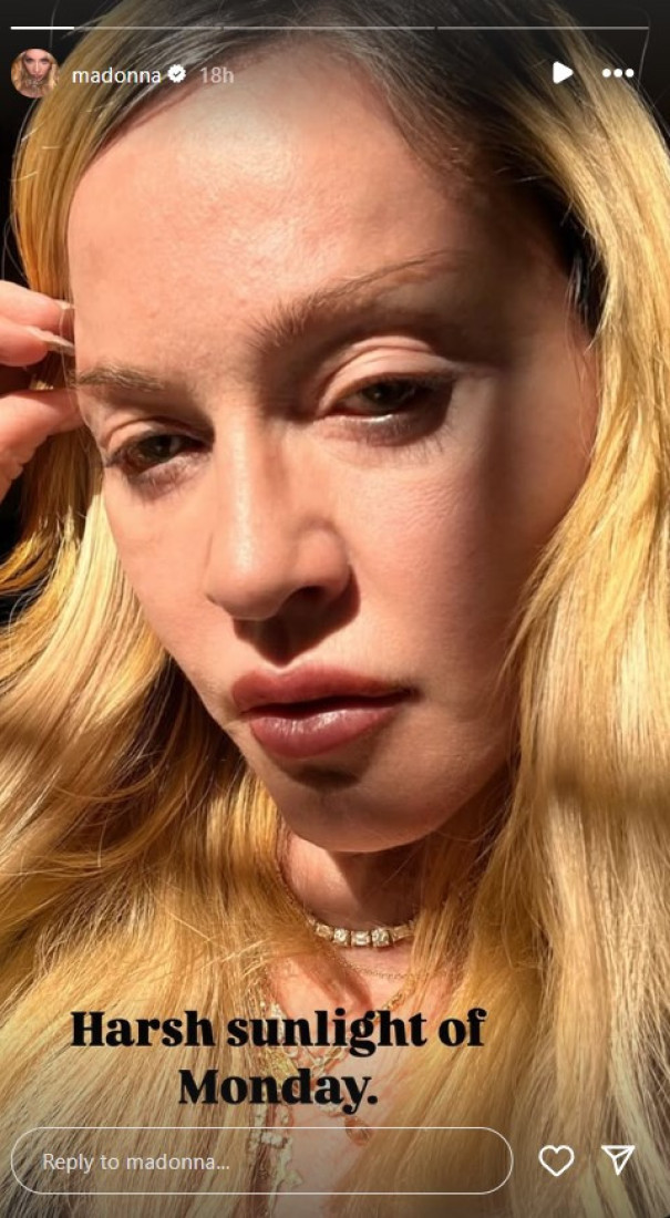 "Ne liči na sebe, izobličila se!" Madonu razapeli na mrežama zbog poslednje objave: Šta joj se dogodilo?
