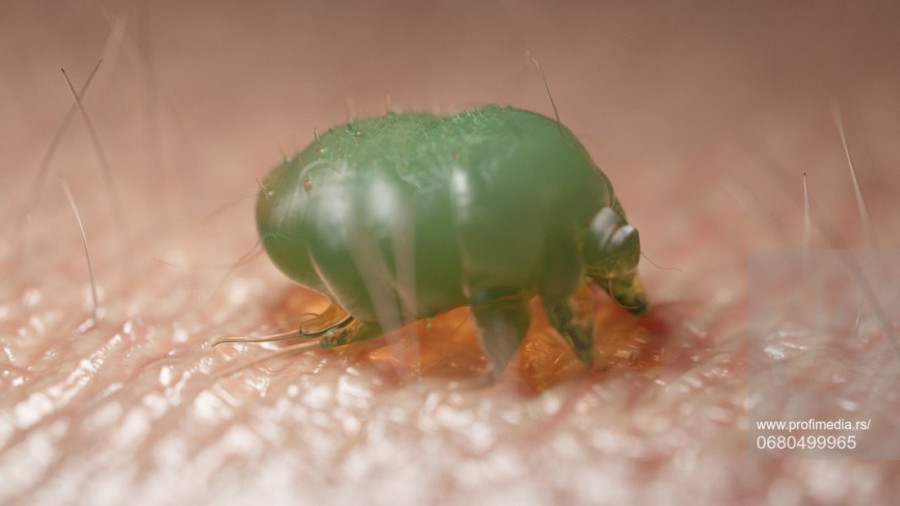 Prijavljena šuga u vrtiću u Beogradu! Ovo su simptomi koje ne smete ignorisati