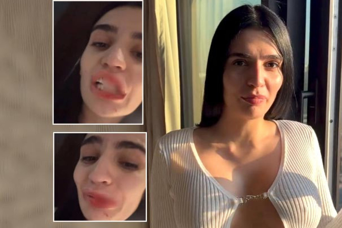 "Šta sam, prosula kečap po faci?" Pretučena influenserka nije tužila dečka: Oglasila se o svemu!