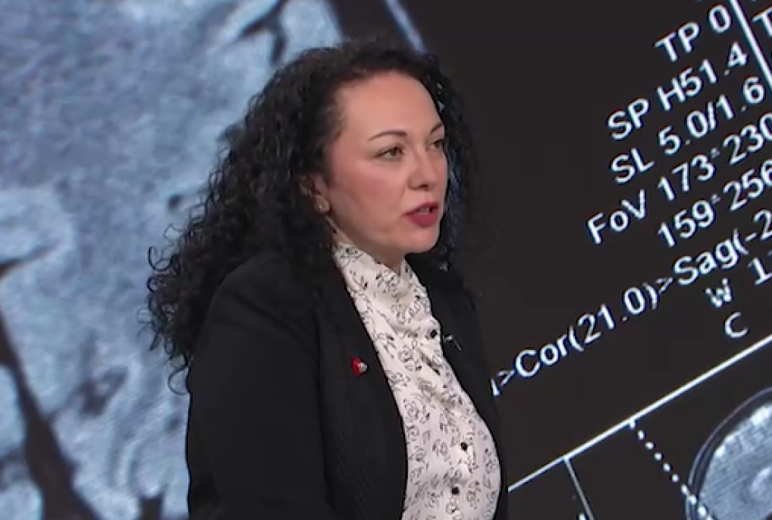 Broj moždanih udara kod mladih je u porastu! Doktorka otkriva kako ih sprečiti