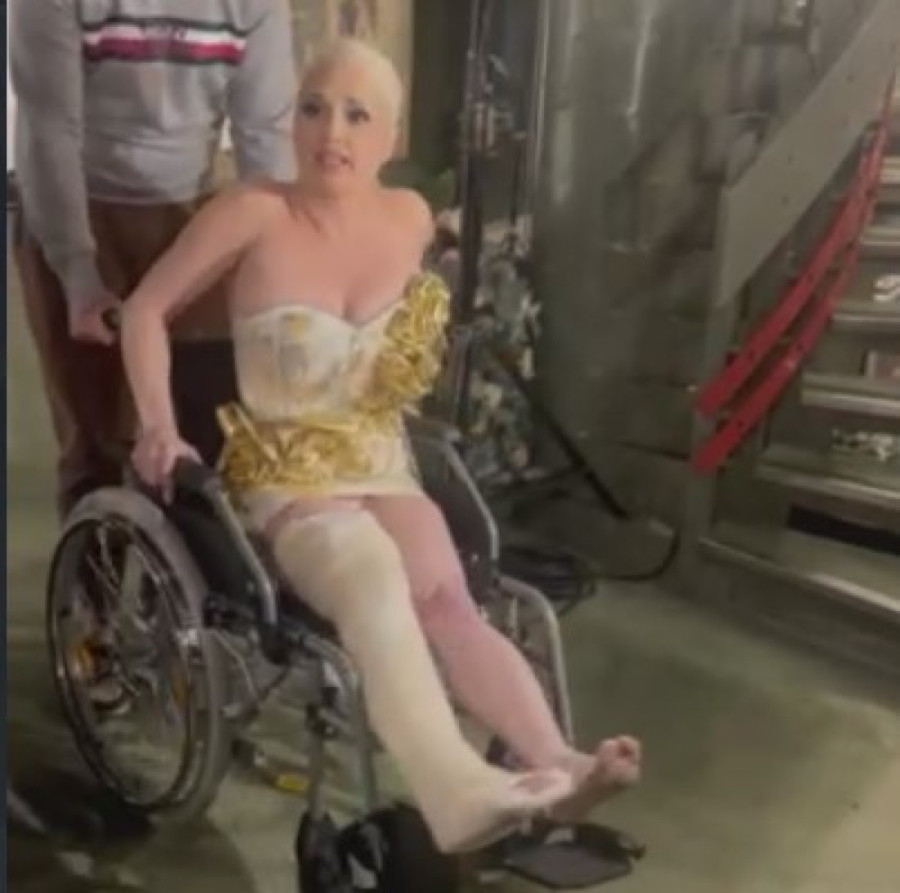 Maja Nikolić tražila da joj doktor skine gips: Zglob mi je smrskan uzduž! Sin Lazar joj pruža najveću podršku (FOTO/VIDEO)