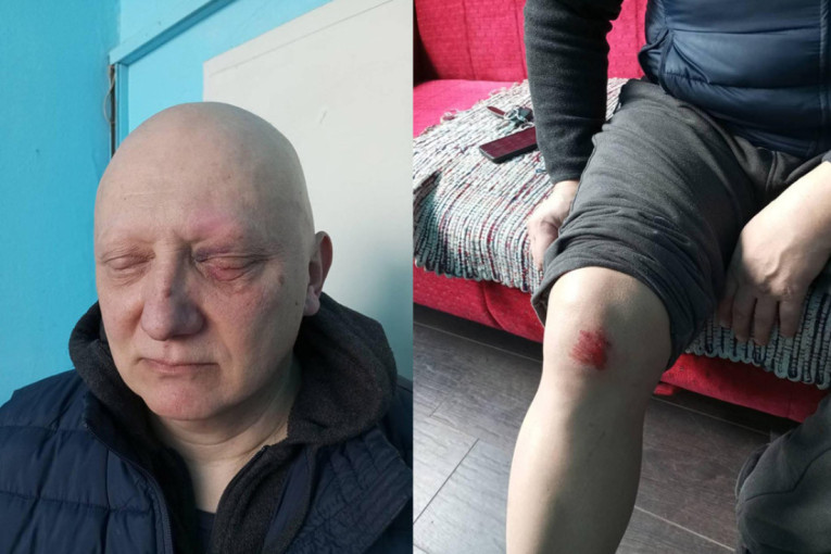 Brutalno prebijanje aktiviste SNS-a u Senti: Da li će se Đilasov i Marinikin nasilnik izvući zahvaljući žutom sudstvu?