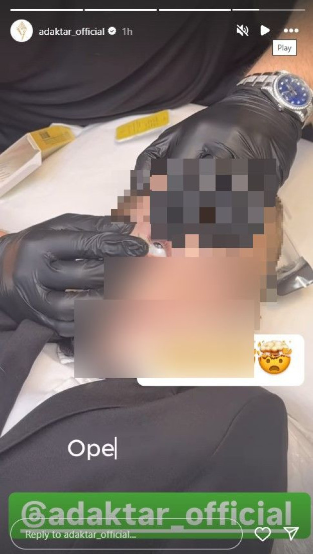 Adam Adaktar šokirao javnost! Stavio četvorogodišnjem sinu sočiva! (FOTO)