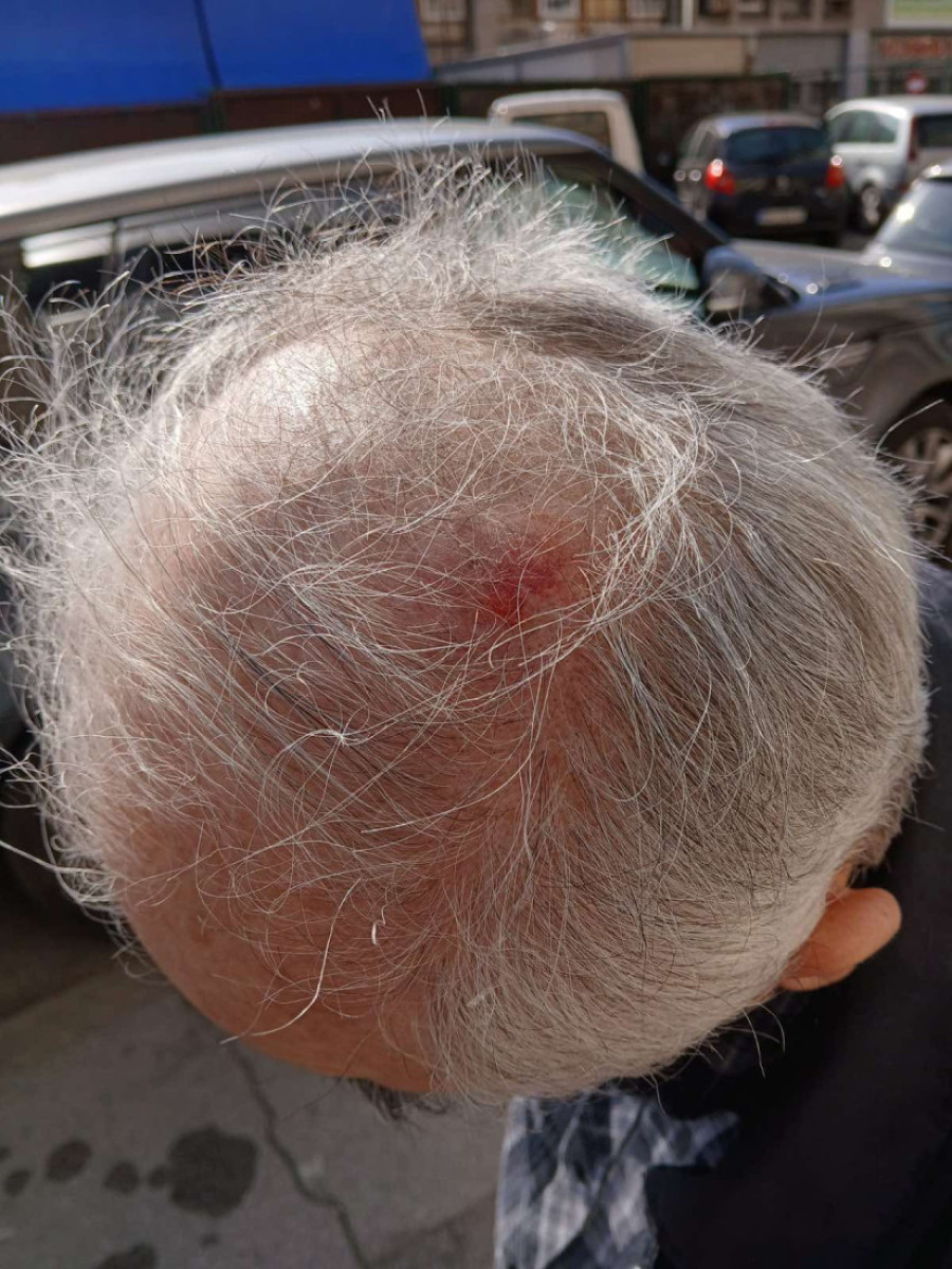 Opozicioni teror se nastavlja: Đilasov tviter agitator divljao na Dorćolu (FOTO/VIDEO)