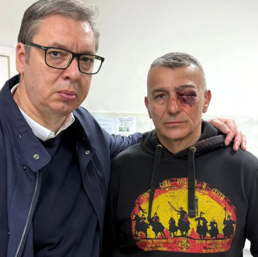 Vučić nakon posete povređenom policajcu: Pitanje je hoće li sačuvati oko, ovo je za mene neverovatno!