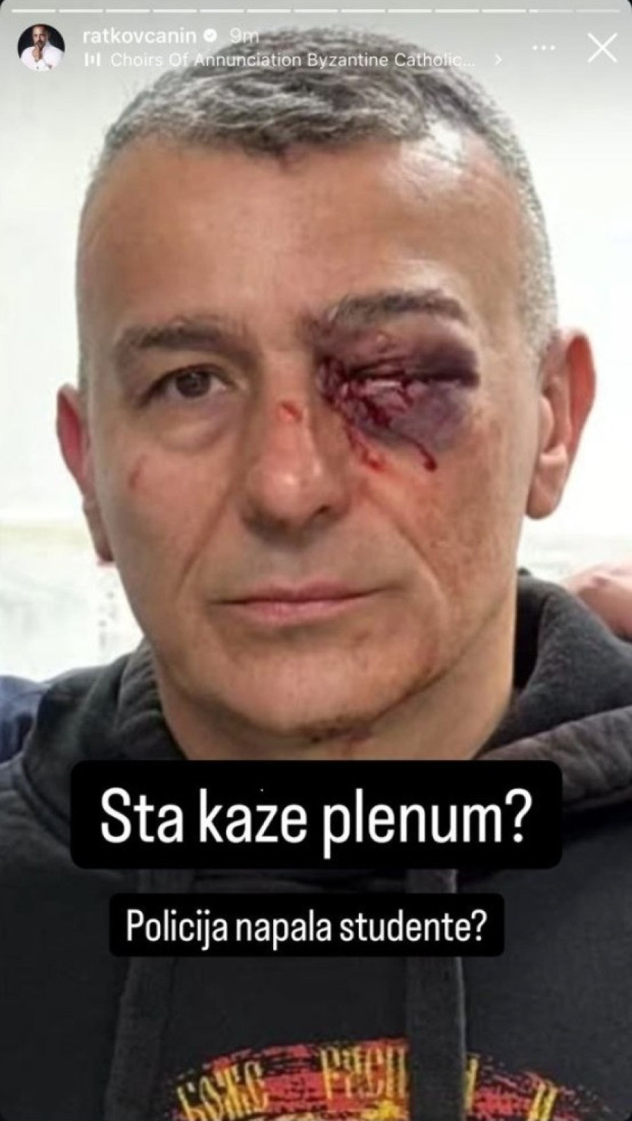 "Šta kaže plenum, policija napala studente?": Branko Babić osudio napad na policajca Lazara Baćića