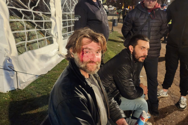 Građani brutalno napadnuti kod Pionirskog parka: Jednom slomljena arkada, drugog šutirali i gađali kolačima (VIDEO)