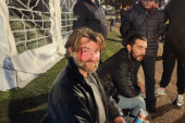 Građani brutalno napadnuti kod Pionirskog parka: Jednom slomljena arkada, drugog šutirali i gađali kolačima (VIDEO)