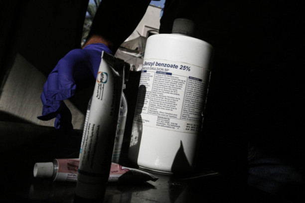 Prijavljena šuga u vrtiću u Beogradu! Ovo su simptomi koje ne smete ignorisati