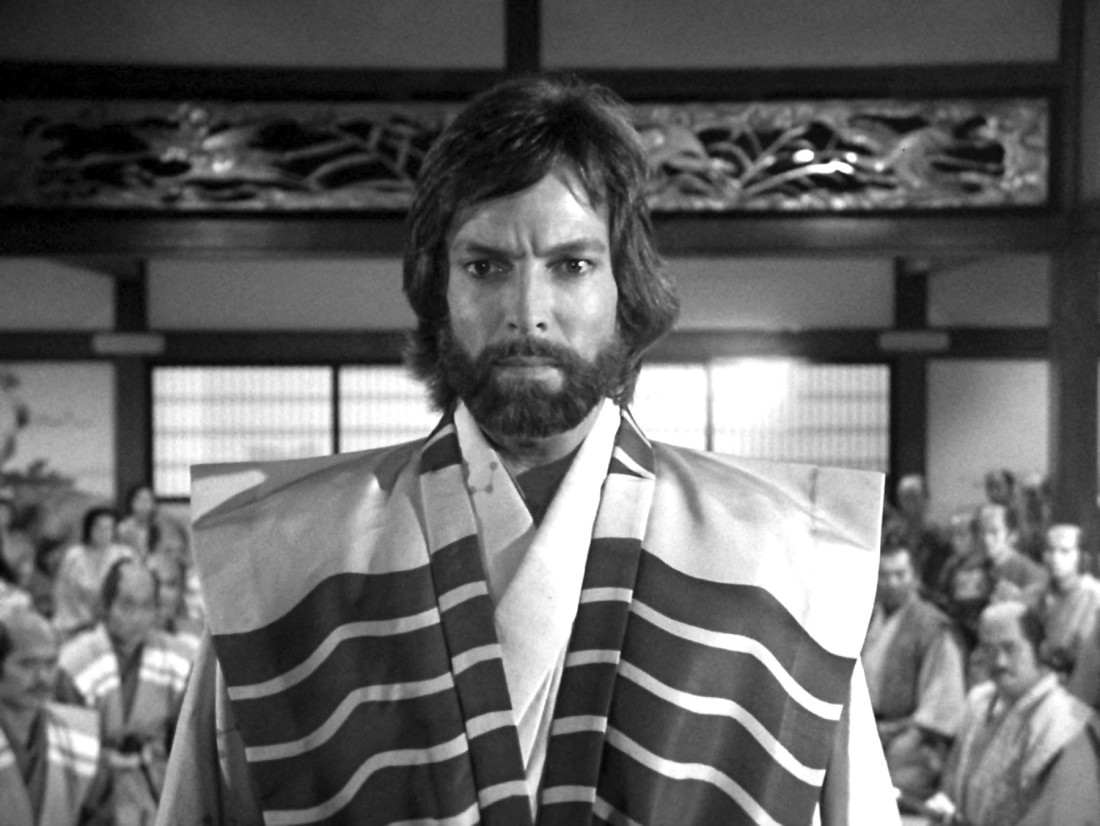 Dok su ga žene obožavale on je voleo muškarca: Životna priča Ričarda Čemberlena (FOTO)