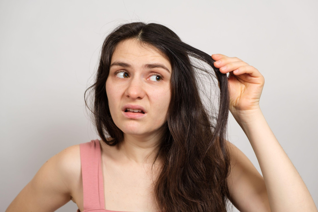 Prosuli ste lak za nokte? Ne posežite odmah za acetonom, može da napravi još veću štetu