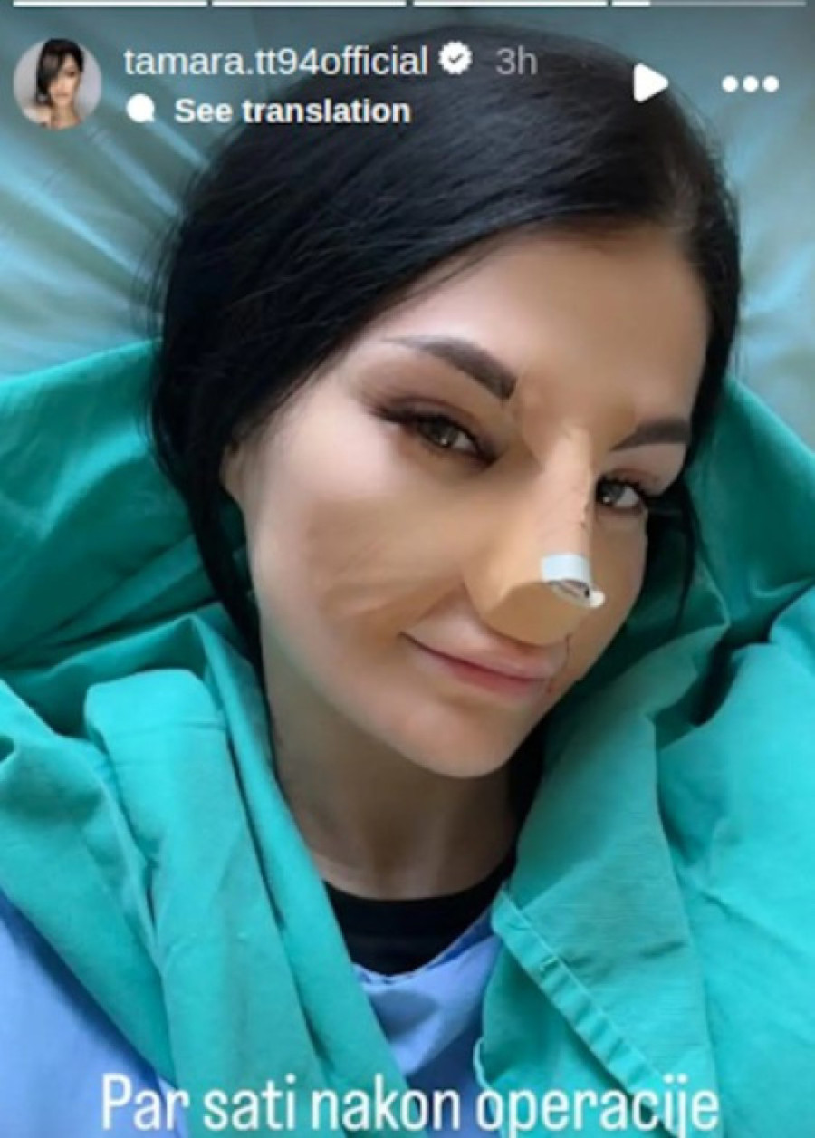 Operisana bivša učesnica "Elite": Cela glava joj u zavojima! (FOTO)