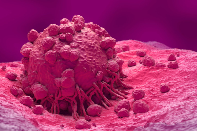 Najopasniji melanom ne liči na mladež! (VIDEO)