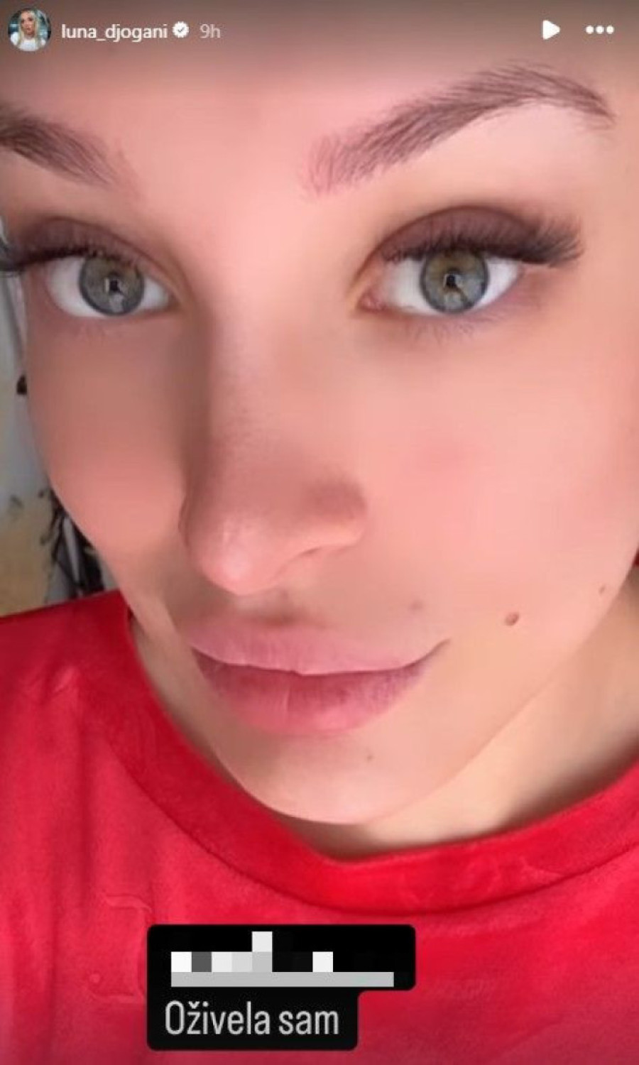 "Oživela sam!" Luna Đogani pokazala i kako izgleda posle hitne intervencije (FOTO)