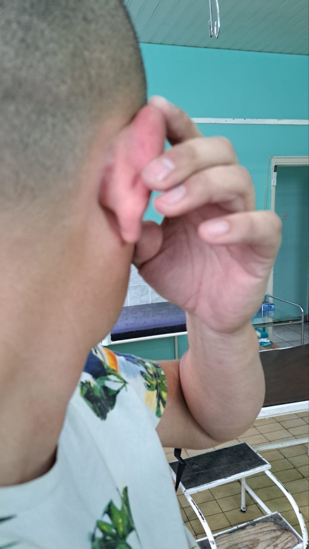 Uhapšen napadač na aktivistu SNS: Teleskopskom palicom napao čoveka