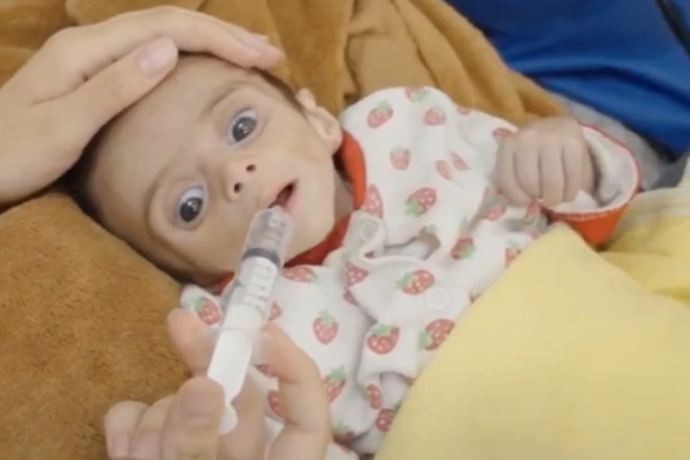 Ovo nisu prizori iz Aušvica, nego iz Gaze, danas: Zbog izraelske blokade ova beba je na samrti, sliku nećete moći da izbacite iz glave