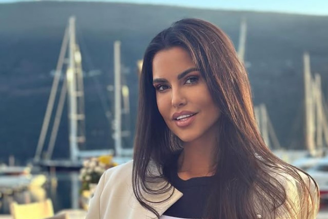 Neviđena transformacija Dijane Dilajn! Nekad je bila plavuša sa pirsingom, a onda se odala estetskim korekcijama (FOTO)