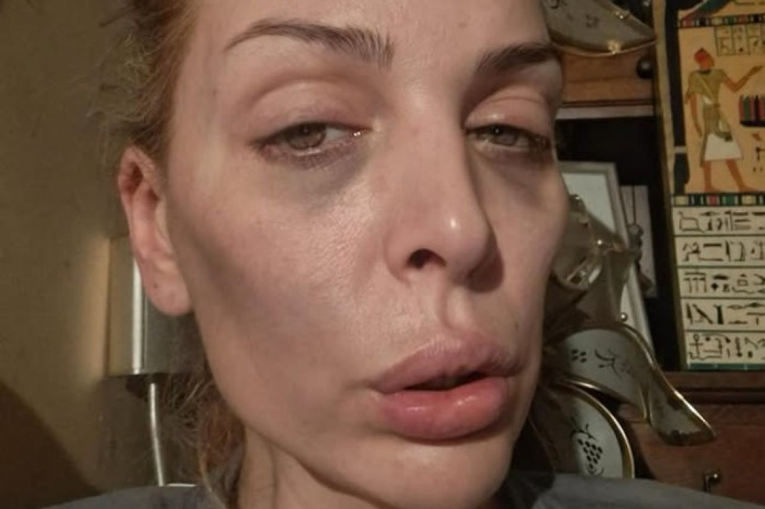 "Infuzije me drže u životu" Avu Karabatić psihički i fizički uništila smrt oca, jedva ustaje iz kreveta!