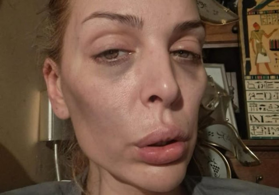 "Majka mi nije izjavila saučešće, niti došla na sahranu" Avi se pogoršalo zdravstveno stanje nakon gubitka oca!