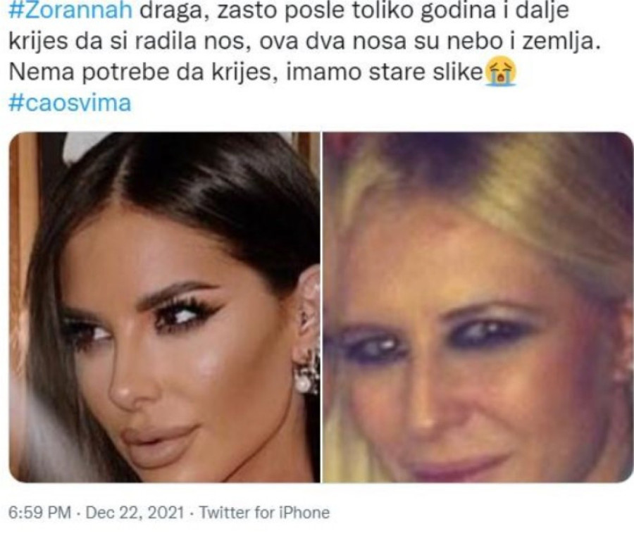 Druga osoba! Zorannah je ovako izgledala pre više od deceniju i estetskih operacija