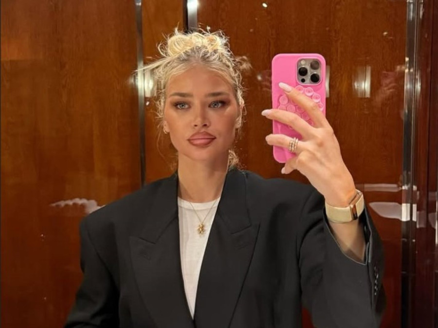 "Kao da su me pčele izujedale"  Estetka korekcija uništila Sofiju Milošević!