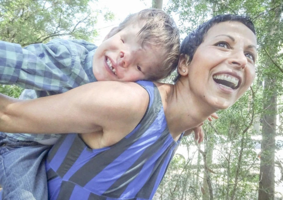 Neverovatna priča dečaka koji je rođen bez očiju, nosa i vilice: Plakali su kad se rodio, a danas svi plaču od sreće! (UZNEMIRUJUĆ SADRŽAJ)
