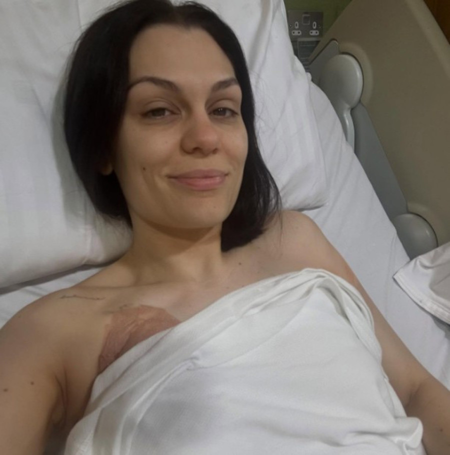 Pevačica otkriva s čime se suočava nakon operacije raka dojke: Kosa mi opada kao luda!