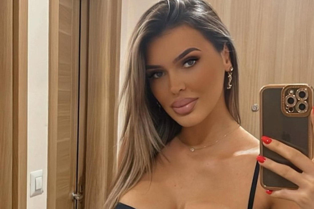 Pevačicu greškom izudarao vlasnik kluba: Klepio me je po glavi, bila sam kolateralna šteta!