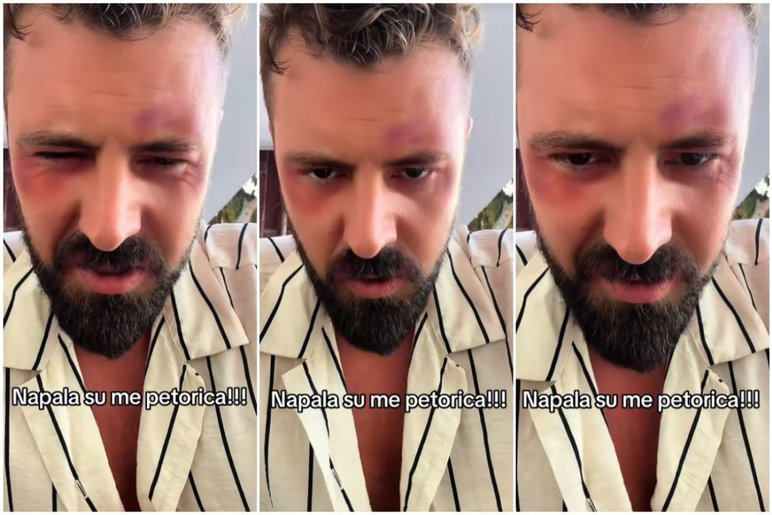 Pretučen pevač! Goran tvrdi da su ga napala petorica: Nije mi dobro, treba mi pomoć