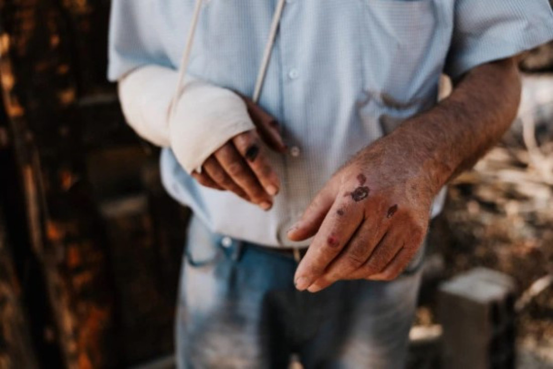 Heroj iz Kuršumlije ne želi da napusti dedovinu nakon što je ostao bez doma: Država odmah priskočila u pomoć,  obezbeđen privremeni objekat