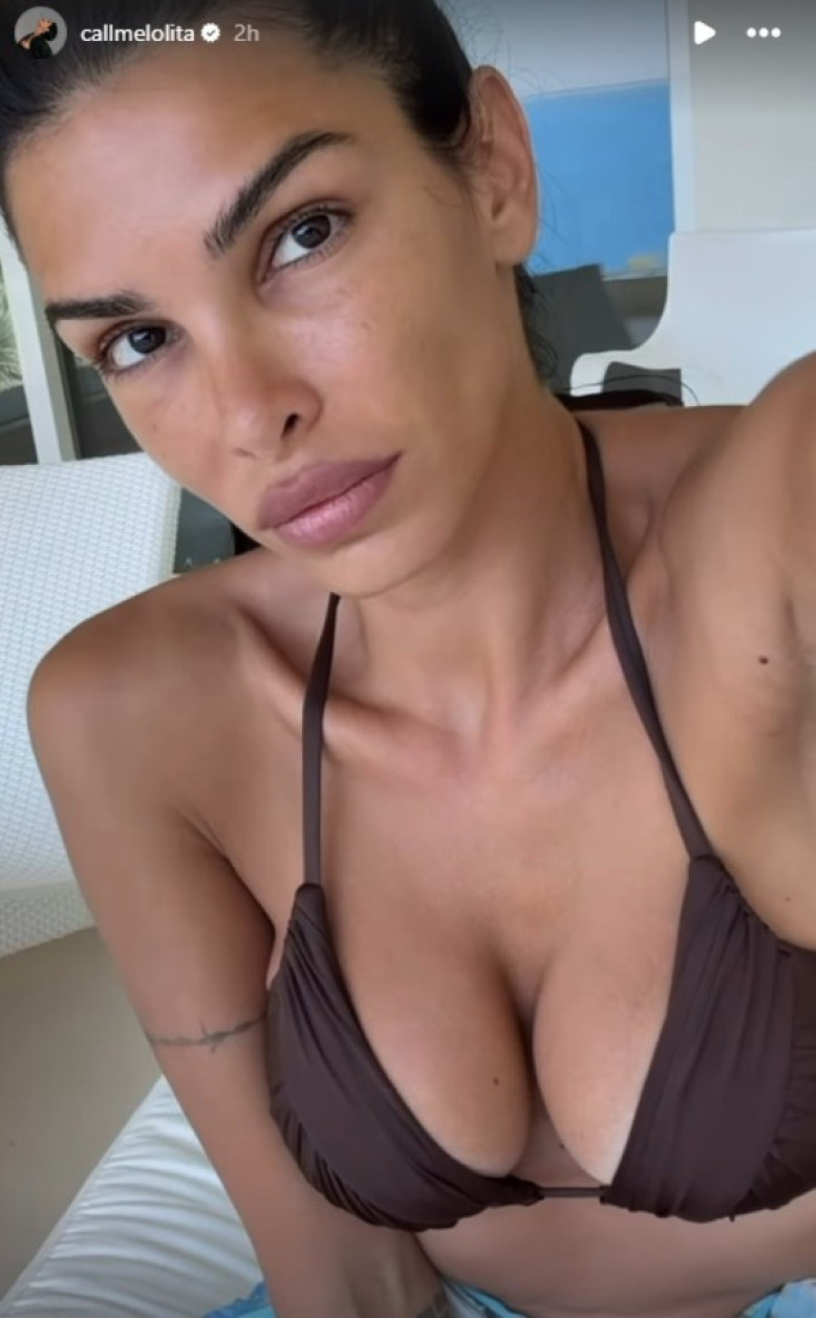 "Otkazivali su mi organi" Manekenka doživela nesreću na snimanju: Bila sam bez kose, sa ljubičastom kožom