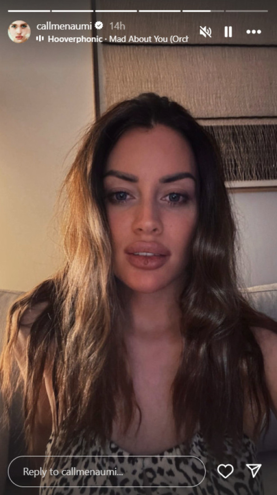 Amidžićevu ženu nema ko nije pitao "za kuglicu na usnama"! Oglasila se pa otkrila s kakvim se problemom suočila