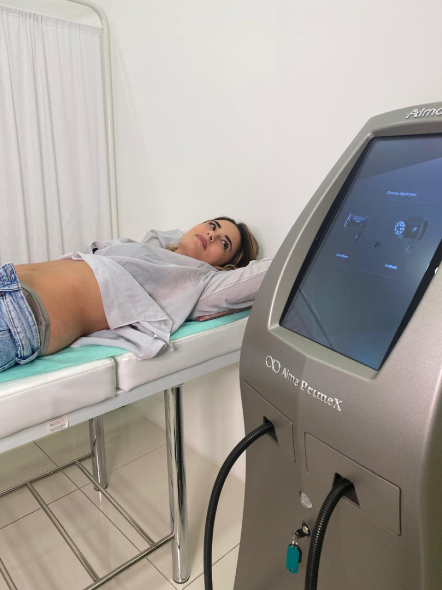 Revolucija u oblikovanju tela: Alma Prime X – vaš saveznik na putu do vitke linije i zategnute kože